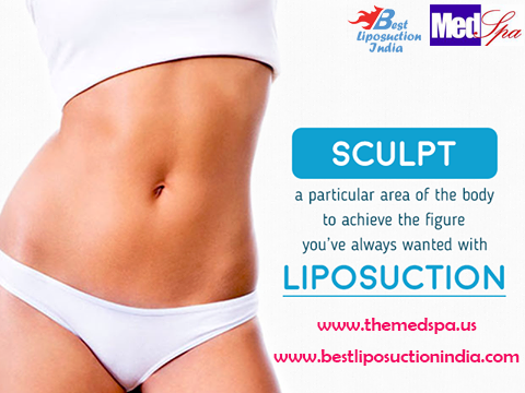 liposuction in Delhi by dr ajaya kashyap cosmetic surgeon
