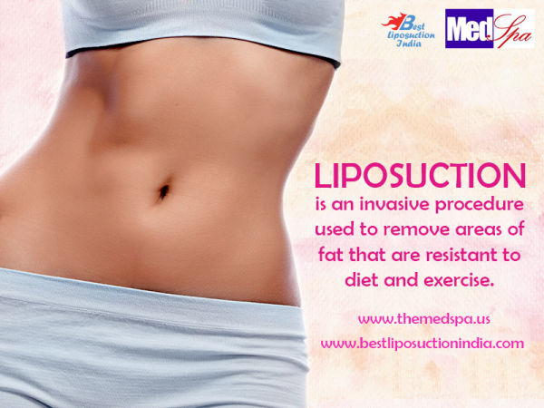 liposuction in Delhi